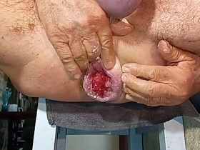 Gapingman 2025-14 asian china gay boys sexual intercourse videos