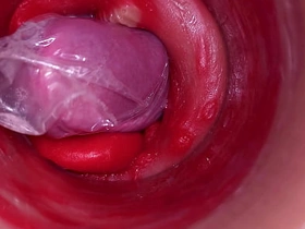 The camera inside the deep pussy records a huge except with regard to a stuck condom asian gay rough sex videos