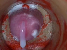 Insemination - Internal Camera Captures Deep Go first Ejaculation asian gay sex videos rub-down