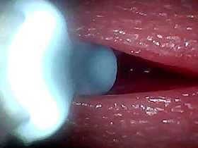 I couldn’t suppose what happens INSIDE the penis as A sperm passes through (endoscopic footage) gay dealings videos asian pakistan
