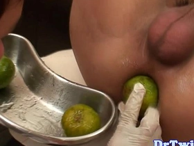 Asian twink prostate checked with big dildo gay sex videos asian permanent