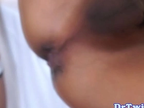 Asian MD slams patient after enema asian gay sex videos on x